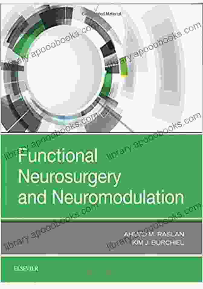 Functional Neurosurgery And Neuromodulation Book Cover Functional Neurosurgery And Neuromodulation Paul McGeough