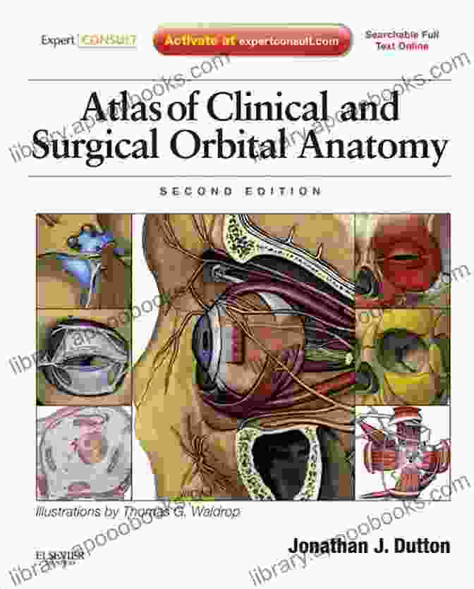 Intraocular Tumors: A Comprehensive Clinical Guide By Jonathan Dutton Intraocular Tumors Jonathan J Dutton