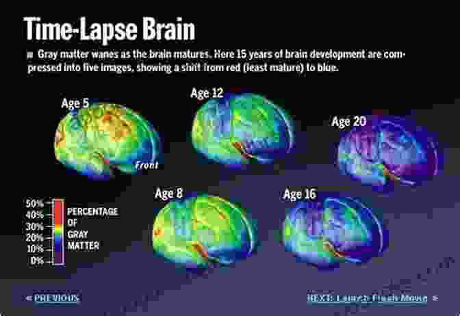 MRI Scans Illustrating Brain Development In Adolescence Attack Of The Teenage Brain Understanding And Supporting The Weird And Wonderful Adolescent Learner