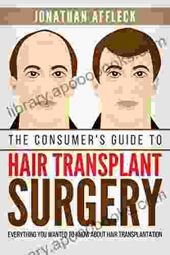 The Consumer S Guide To Hair Transplant Surgery: Everything You Wanted To Know About Hair Transplantation